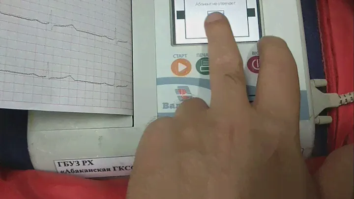 Передача ЭКГ в режиме GSM на аппарате "ВАЛЕНТА"